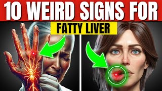 Top Symptoms of Fatty Liver That Can’t Be Ignored [upl. by Maurice]