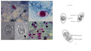 Cystoisospora amp Cystoisosporiasis Cystoisospora belli [upl. by Dittman]