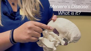 Vertigo Vs Menieres Disease Chiropractor in St Charles IL [upl. by Tressa]