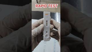 Rapid test informationdmlt labtechnician [upl. by Stavro732]