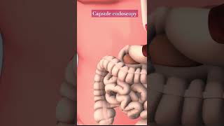 Capsule endoscopy healthsciences nursingstudent technology endoscopy science shorts [upl. by Eisler]