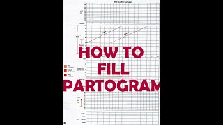 HOW TO FILL PARTOGRAM  VERY EASY [upl. by Firehs923]