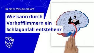 Wie kann durch Vorhofflimmern ein Schlaganfall entstehen In einer Minute erklärt [upl. by Kilam671]