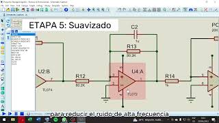 Proyecto Electromiograma [upl. by Nagirrek]