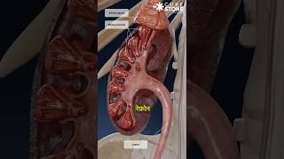 How kidney stones are removed  RIRS  How urine is formed  Laser treatment shorts [upl. by Paulson]