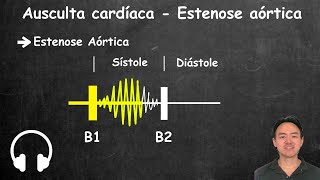 Ausculta cardiaca estenose aortica e insuficiencia aortica [upl. by Algie]