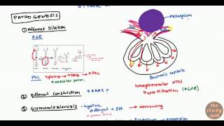 Diabetic Nephropathy for USMLE Step1 and USMLE Step 2 [upl. by Marentic]