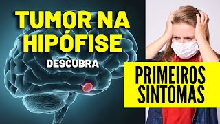 Tumor de Hipófise  O Que é Tumor na Hipófise [upl. by Haimes]