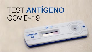 Test Antígeno COVID19 Clínica CEMTRO [upl. by Otilopih]