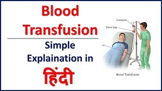 Blood Transfusion simple explaination in Hindi  Bhushan Science [upl. by Voorhis277]