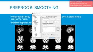 preprocessing fmri data in SPM12 [upl. by Enniroc]