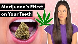 What Does Marijuana Do To Your Teeth [upl. by Echikson]