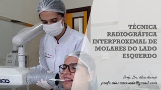 Técnica radiográfica interproximal de molares do lado direito [upl. by Eniretac686]