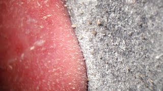 Pore Strips removal close up Blackheads removal [upl. by Drobman]