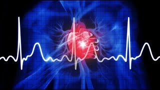 SVT AF VT VF Aritmiler EKG 2 [upl. by Olracnaig543]