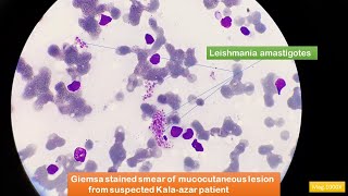 Leishmania amastigotes Microscopy [upl. by Nosduh787]