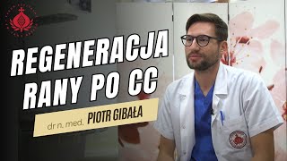 Ginekologia u Bonifratrów odc 10  regeneracja rany po cięciu cesarskim [upl. by Sanger]