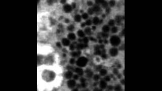 NIDCR Granules in a Salivary Acinar Cell [upl. by Treve]