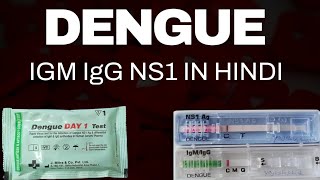 Dengue Test Kaise Kiya Jata Hai  डेंगू परीक्षण  Dengue Positive  Dengue test report  dengue [upl. by Niamrej]