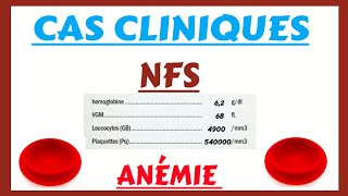 Cas cliniques  Interprétation nfs  ANÉMIE [upl. by Natsud97]