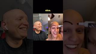 I GET EYEBROWS comedy funny lol alopecia bald mcsquared90 [upl. by Sydney]