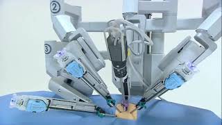 About Robotic Surgery  UP Health System  Marquette [upl. by Hovey]