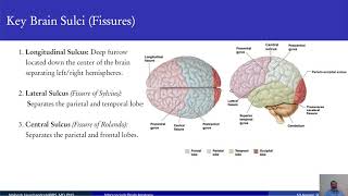 02 Anatomical Macroscopic structure of the CNS [upl. by Elawalo]