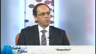 Akupunktur nedir Faydaları nelerdir [upl. by Peony]