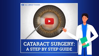 What to Expect During amp After Cataract Surgery [upl. by Rednaskela258]