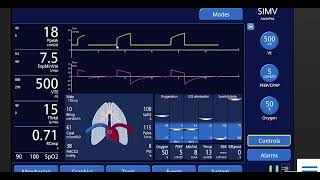 modes of ventilation in rapid review [upl. by Dene]