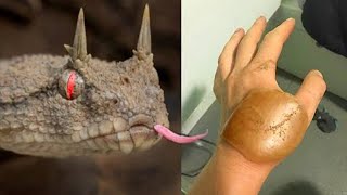 20 Most Painful Snake Bites In The World [upl. by Tracey82]