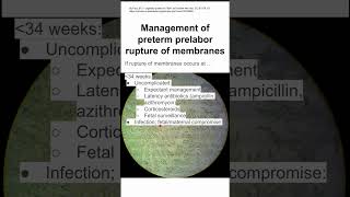 Management of preterm prelabor rupture of membranes [upl. by Levins]