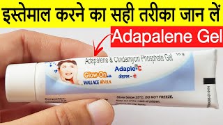 Adapalene Gel  Adapalene And Clindamycin Phosphate Gel  Adapalene Gel For Pimples  Adaple C Gel [upl. by Raseda]