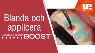 Blanda och applicera Opalescence™ Boost™ för medicinsk tandblekning på kliniken [upl. by Aiva29]