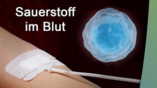 Lungenfibrose Thrombose und intravenöser Sauerstoff  ein Patientenfall [upl. by Netnerb]