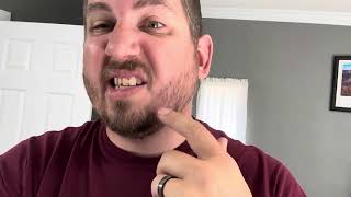 Does It Work On Beards Used for A Month Does It Help Real Review of Kirkland Minoxidil [upl. by Prent517]