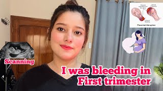 I was bleeding in my first trimester  Early Pregnancy  Life With Kainat [upl. by Malley463]