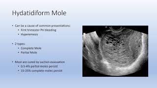 Gestational Trophoblastic Disease GTD [upl. by Allred]