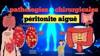 cours S3  Pathologies Chirurgicales et SI  Péritonite aigue 💊🩺💉🩸 شرح سهل 📚و 📚 مبسط للفهم [upl. by Christean391]