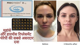 PROGYNOVAEstradiol2mg Tabletमुंहासे और हारमोंस रिप्लेसमेंट थेरेपी की सबसे असरदार दवा Full Review [upl. by Babbette]