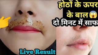 इस चीज से होठों के ऊपर के बाल ऐसे हट गए😱 2 मिनट में मैं तो हैरान हू🤔 upper lip hair removal [upl. by Phaih289]