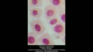 Mitosis  Cell Division different stages under Microscope biology neet agriculture genetics [upl. by Leanne862]