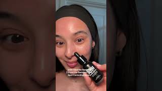 How to get rid of hyperpigmentation and acne scars [upl. by Tibbetts]