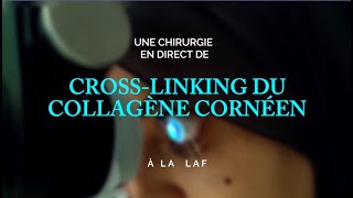 Procédure en direct de CROSSLINKING DU COLLAGÈNE CORNÉEN à la LAF Réalisée par Pr FARHAD HAFEZI [upl. by Ashwin]