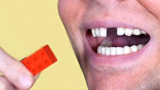 LEGO TOY BREAKS TOOTH [upl. by Kenta]