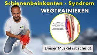 Shin Splints Schienenbeinkantensyndrom  Die 3 Besten Übungen  Ursache amp Lösung [upl. by Grinnell]