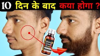 Ustraa Advanced Beard Growth Oil After 10 Days Review Best Beard Oil For Patchy Beard in India 2024 [upl. by Abihsat]