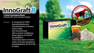 New Product Launch Introducing InnoGraft B with Clinical Case [upl. by Malvie827]