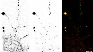 MAP6 and NPYPositive Secretory Vesicles Dynamics in Neurons [upl. by Schwinn]