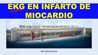 ELECTROCARDIOGRAMA EN INFARTO DE MIOCARDIO I [upl. by Fryd]